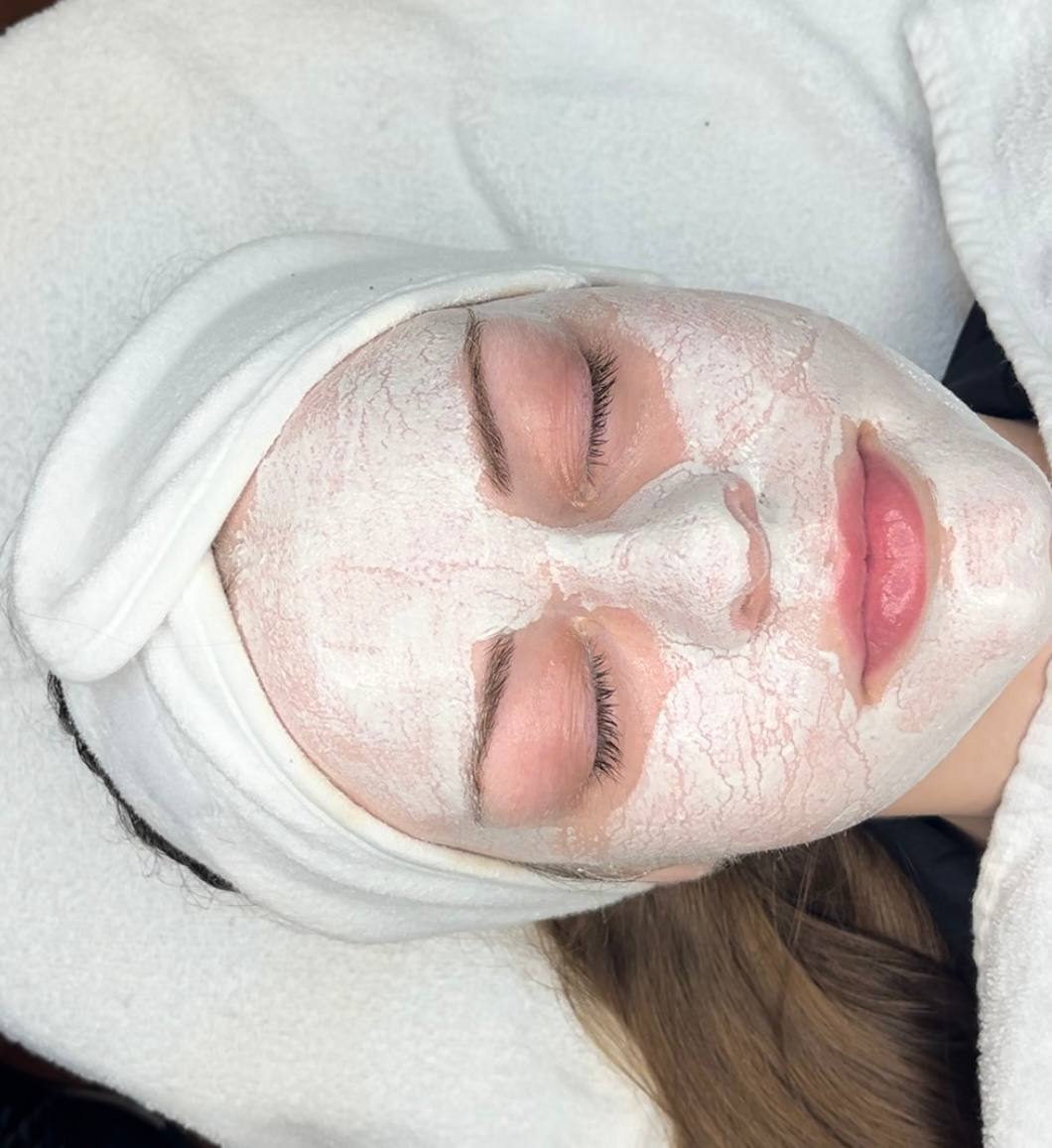 Before and After - Facial Treatment